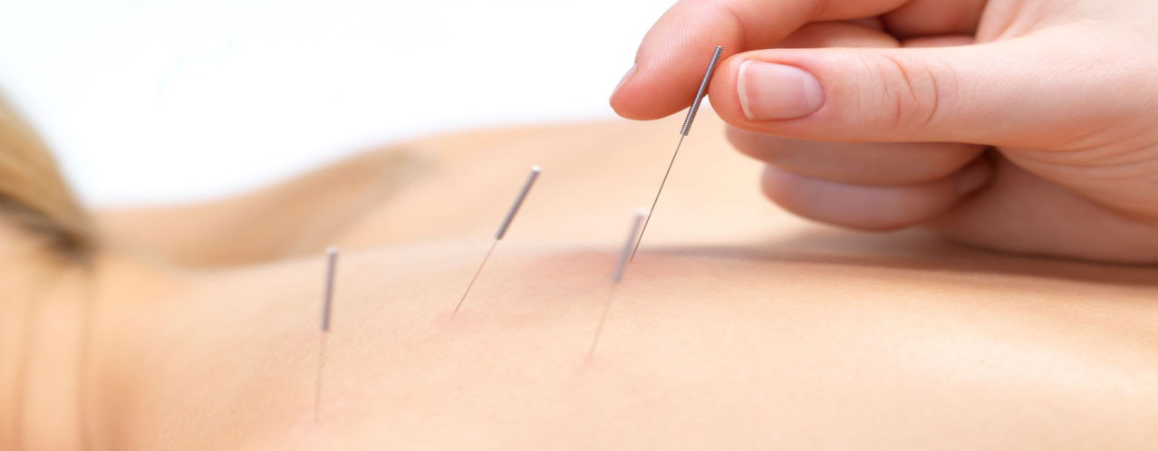 Akupunktura i Homeosiniatria